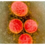 Europe health official warns monkeypox cases could ‘accelerate’