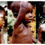 Risk of monkeypox spreading widely ‘very low’: EU agency