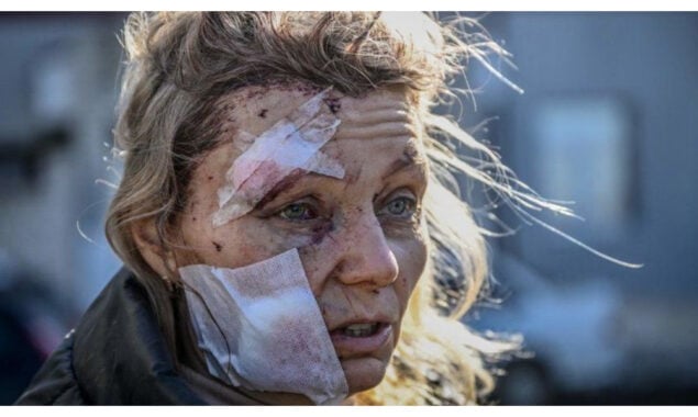 Ukraine First Lady says war ‘horrors’ will leave deep scars