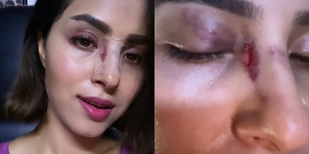 Nimra Khan opens up about abusive marriage