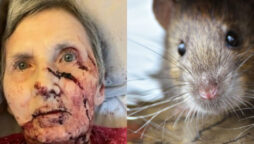 A 76-year old disabled woman was attacked by a rat