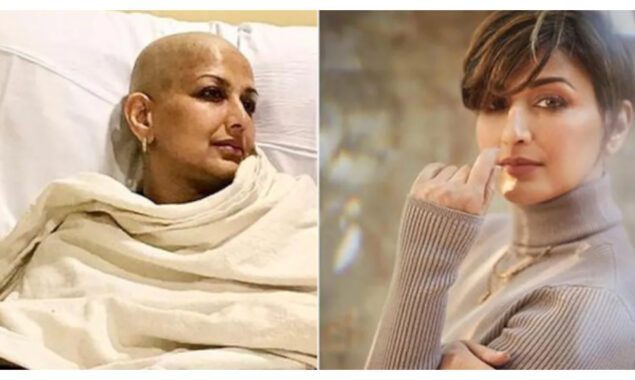 Sonali Bendre claims that her cancer procedure left her with a 23-24-inch scar