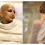 Sonali Bendre claims that her cancer procedure left her with a 23-24-inch scar