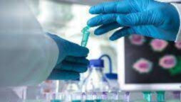 New York City: A citizen tested positive for the monkeypox virus