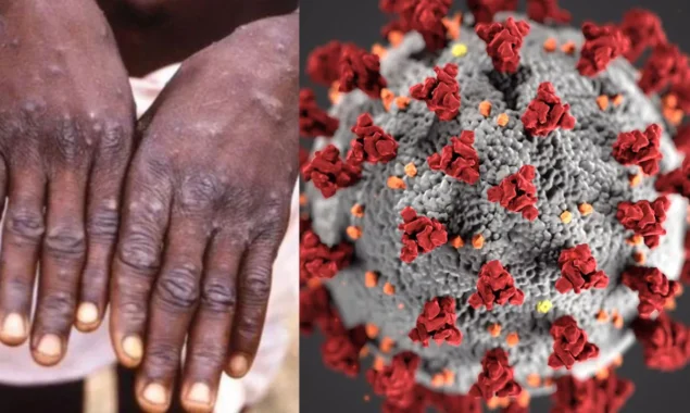 Probability of Pandemic? How is it different from chicken pox? Monkeypox Q/A