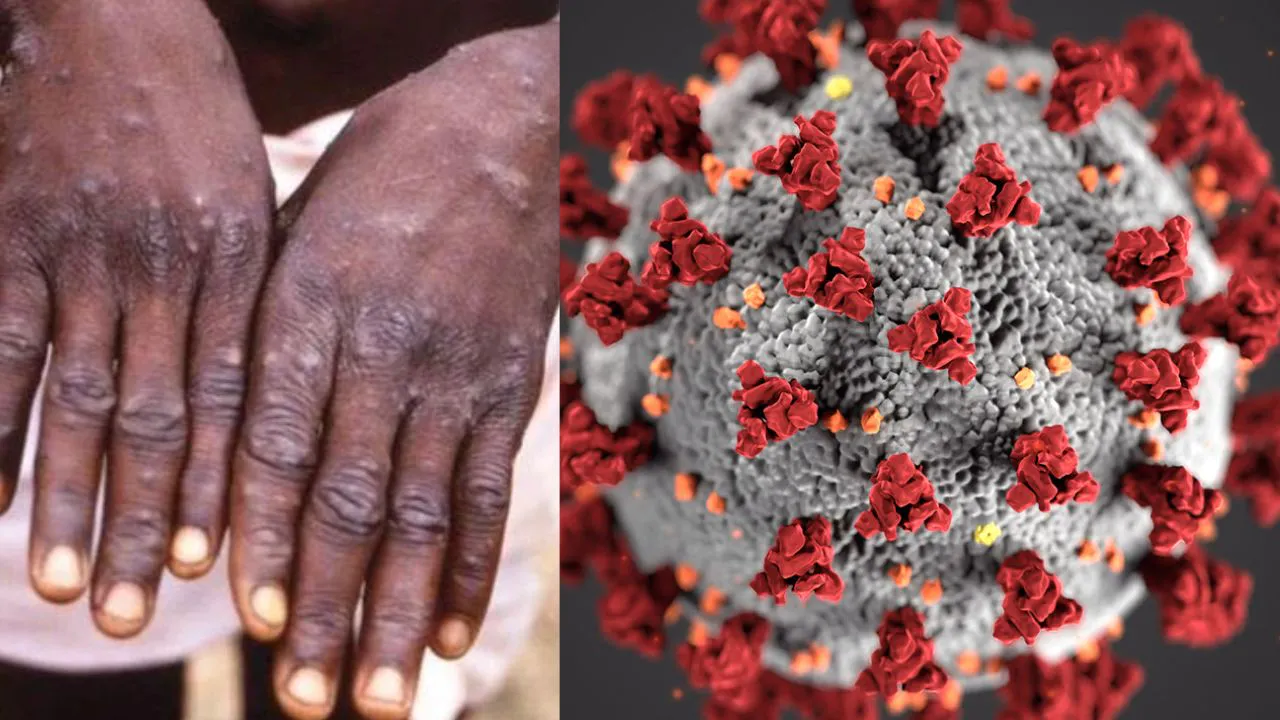 monkeypox