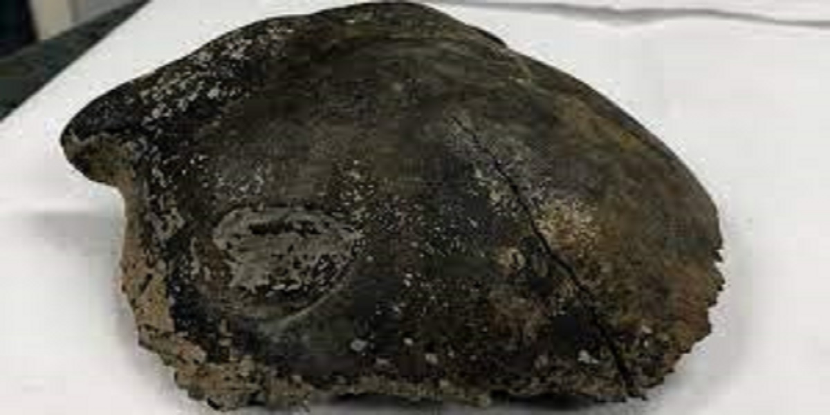 human skull