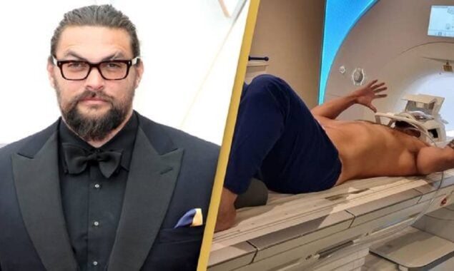 Jason Momoa has an MRI scan after suffering a head injury