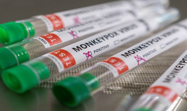 Ireland reports its first case of Monkeypox