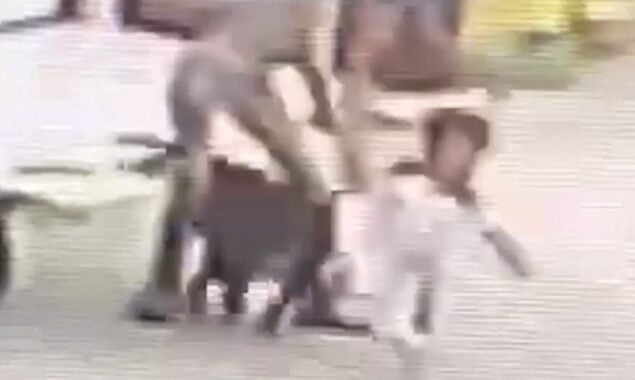 toddler mauled by dog