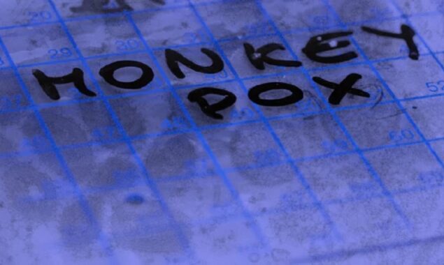 UK: Monkeypox cases jumps above 300