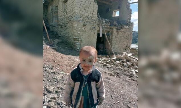 Afghanistan Earthquake: Heart Wrenching Photo of Afghan kid following earthquake goes viral