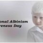 Albinism: lack of melanin plagued by deadly myths