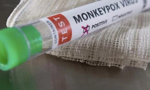 WHO to assess if monkeypox an international health emergency