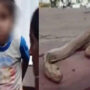 Snake died after Biting  4-Year-Old in Gopalganj? Viral Video