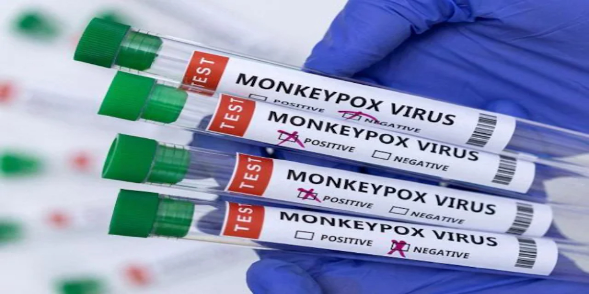 monkeypox