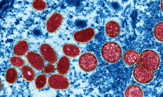 Monkeypox is no longer classified as an endemic disease by the WHO