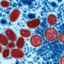 Monkeypox is no longer classified as an endemic disease by the WHO