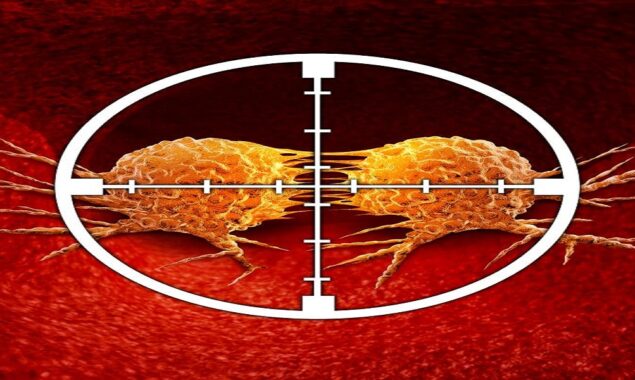 Drug trial raises hopes for treatment of rectal cancer patients