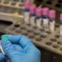 According to WHO, monkeypox is not a global public health emergency.