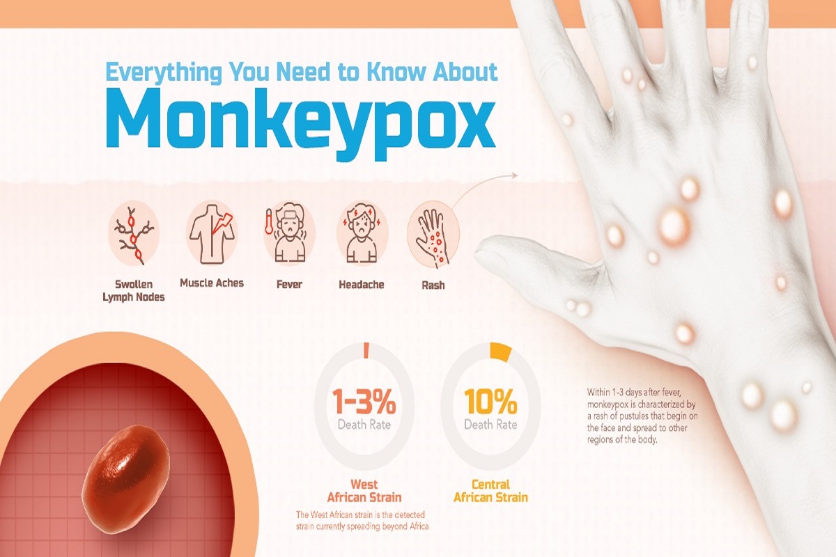 monkeypox