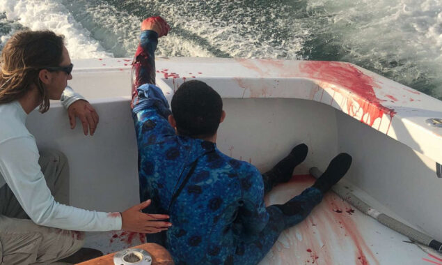 Victim of shark attack in Florida suffering from severe injuries