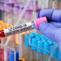 UK Covid infections rise due to Omicron virus