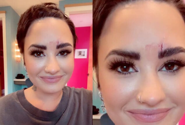 Demi Lovato