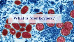 San Francisco, New York on alert as Monkeypox cases rise