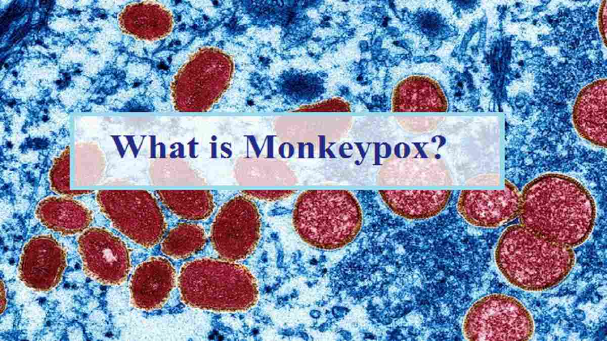 Monkeypox