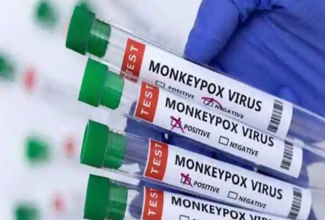 No monkeypox case reported in Pakistan so far: Health Ministry