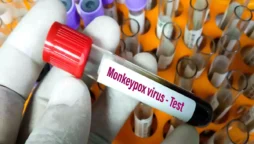 monkey pox in South Florida rises