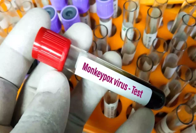 Vaccination increase as the number of monkeypox cases rise in South Florida