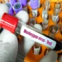 Vaccination increase as the number of monkeypox cases rise in South Florida