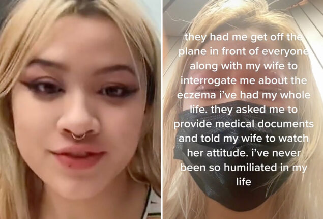 Just a rash, not monkeypox as girl kicked off the flight