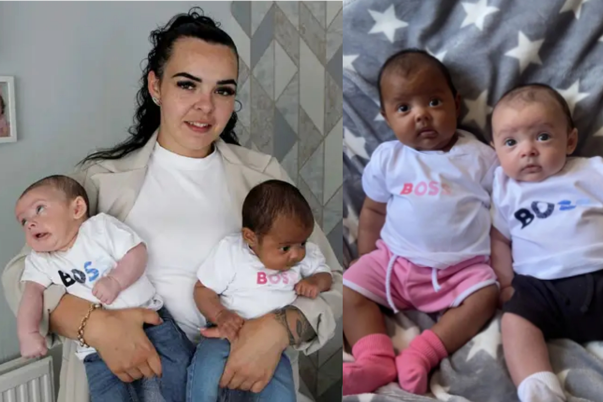 black and white twins