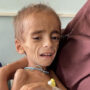 Afghanistan’s public healthcare is getting worse, babies are dying