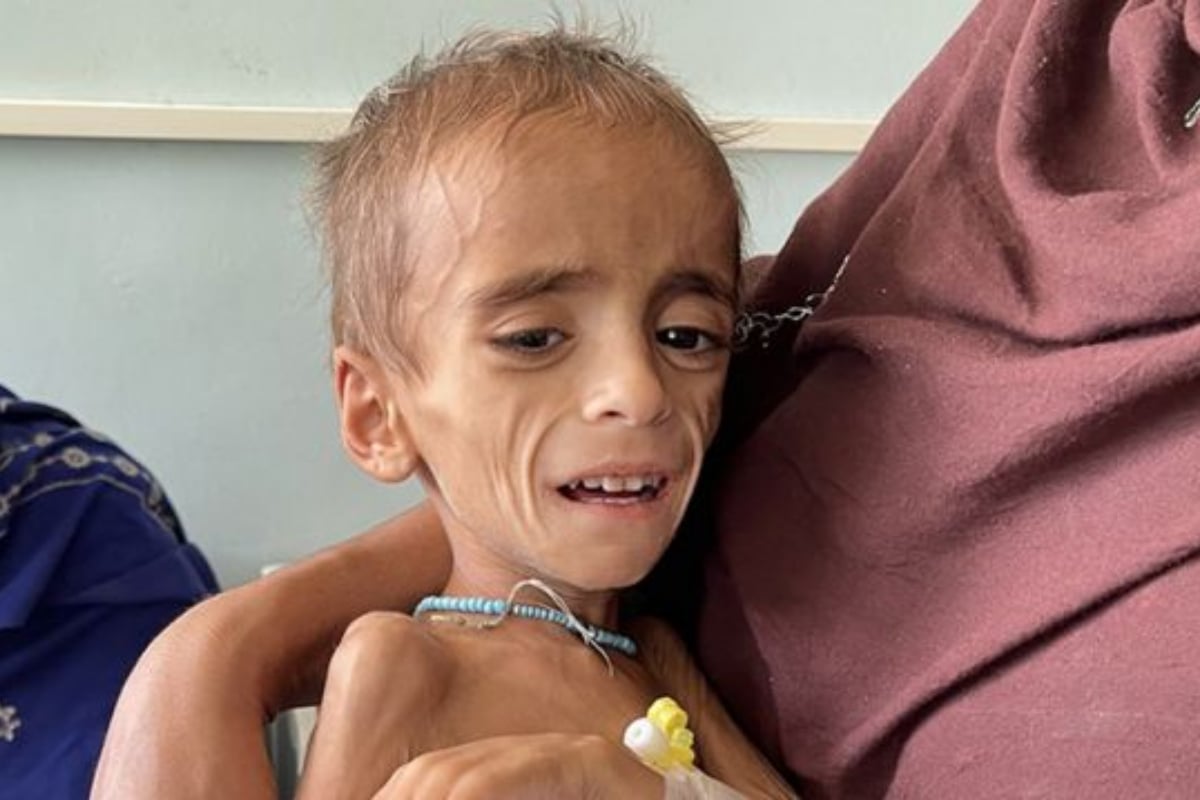 Afghanistan’s public healthcare