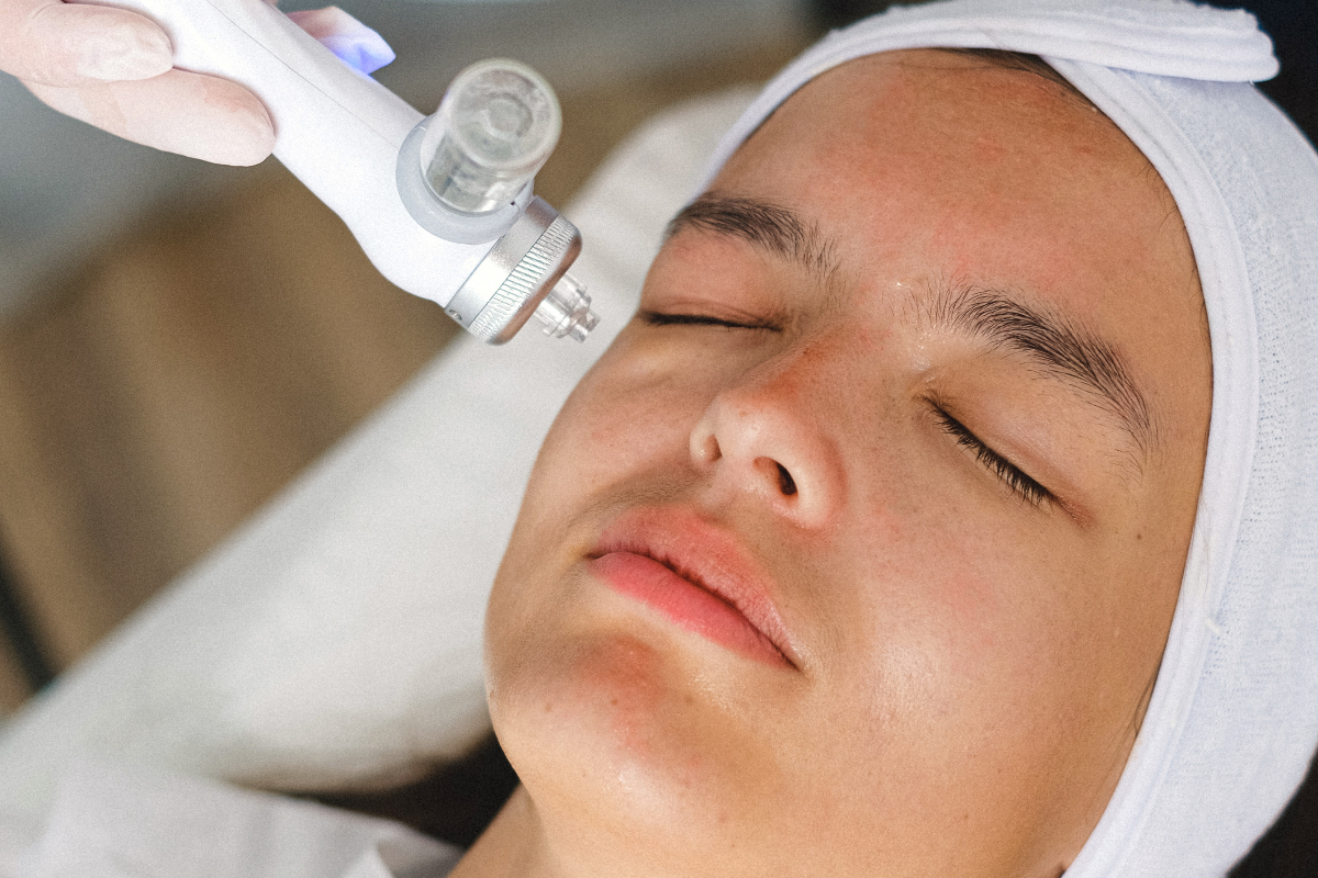 10 benefits of oxygen facial