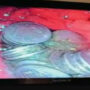 Doctors remove 63 Rs 1 coins from a 36-year-old Jodhpur man