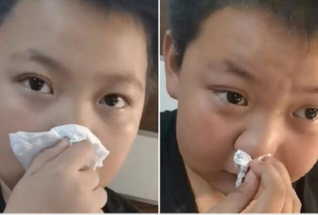 Chinese boy claims to be allergic to smell of books