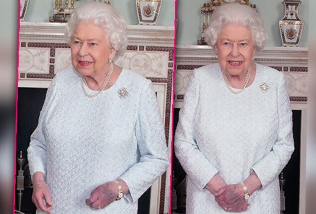 Big bruise on hand of Queen Elizabeth left fans worried