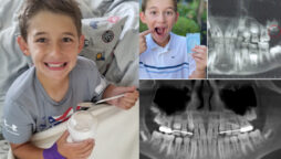 Ryan Scarpelli is youngest person in world to have his wisdom tooth removed