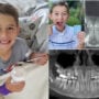 Ryan Scarpelli is youngest person in world to have his wisdom tooth removed