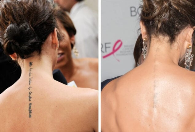 Victoria Beckham removes tattoo of husband David Beckham’s initials