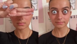 huge eyeballs