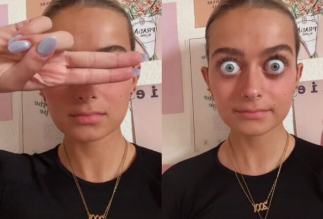 Woman with “huge” eyeballs trolls for “ruin” her face