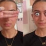 Woman with “huge” eyeballs trolls for “ruin” her face