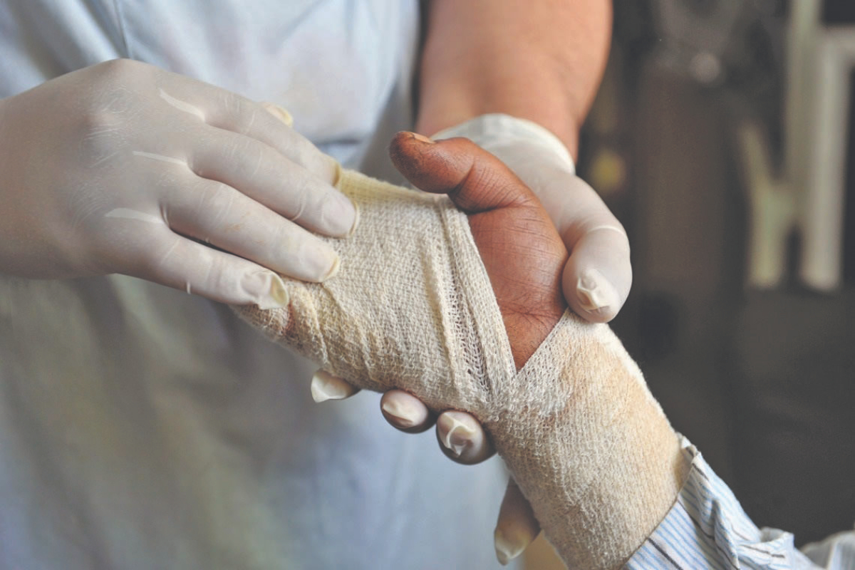 No hope for burn victims
