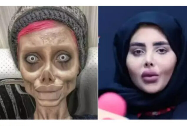 Iranian ‘Zombie Angelina Jolie’ appeared normal in a TV interview after being released from prison